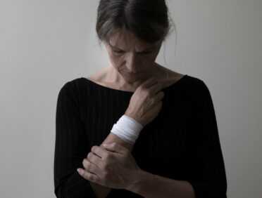 Safeguarding Adults at Risk Physical Abuse image of a woman with an injury for a Learn Q article